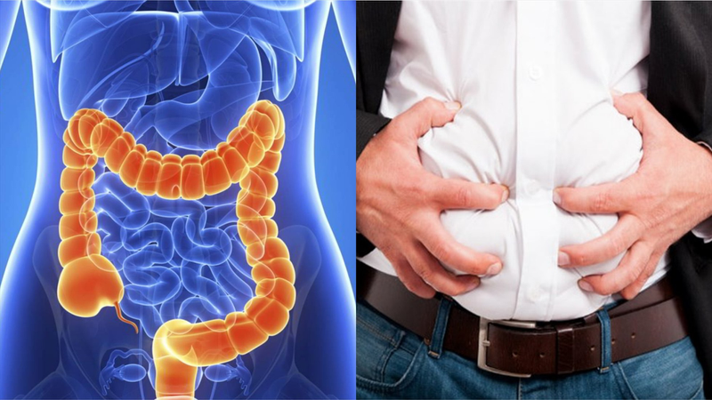 Ăn nhiều đồ dầu mỡ có thể làm tăng nguy cơ mắc ung thư ruột kết